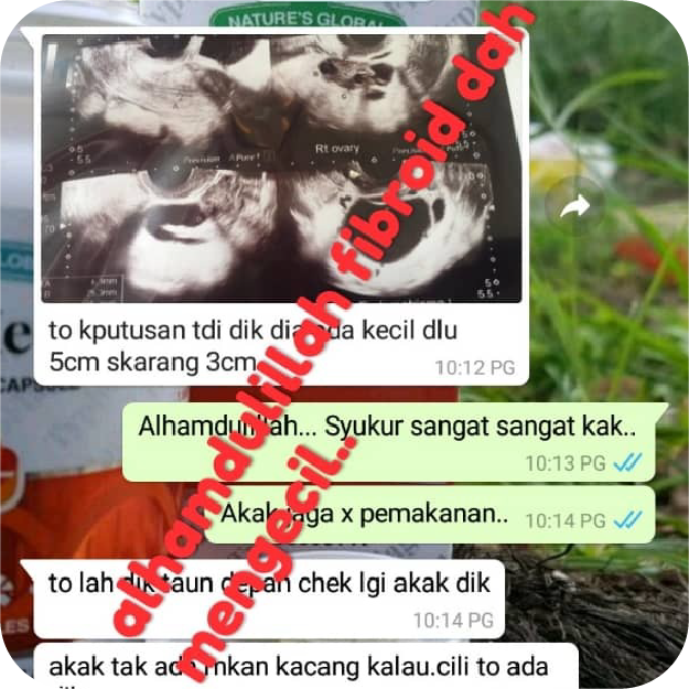 250323 TESTIMONI MYMEDI-06